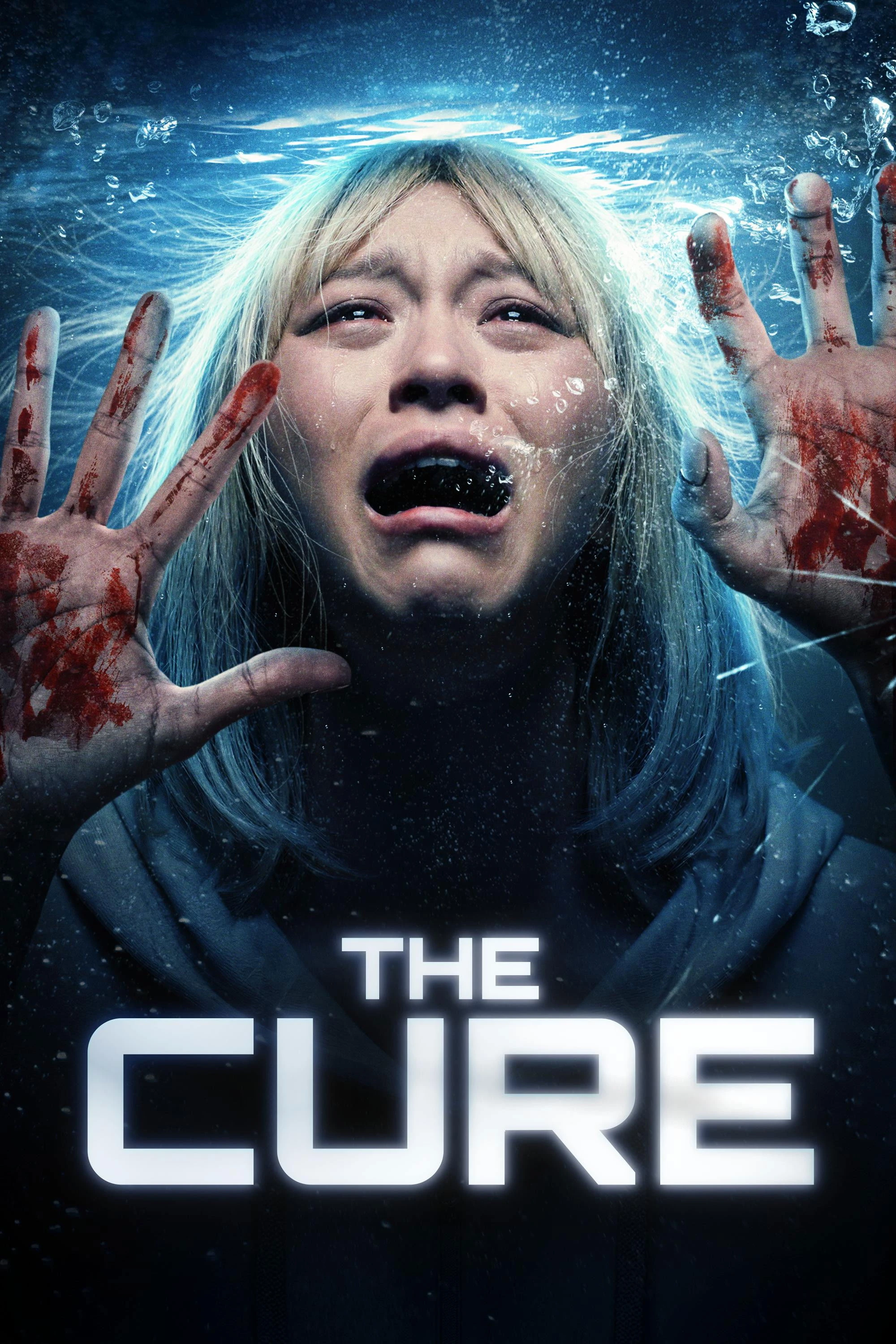 Xem phim Phương thuốc chữa bệnh - The Cure